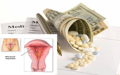 Chi phí chữa viêm nội mạc cổ tử cung trong năm 2018 có đắt không?
