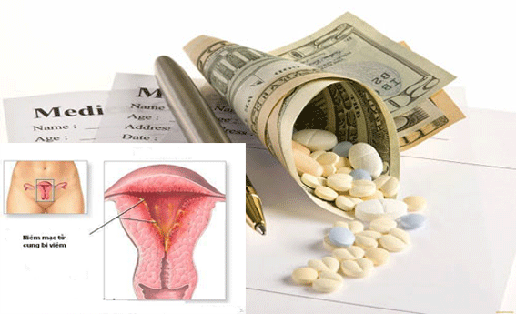 Chi phí chữa viêm nội mạc cổ tử cung